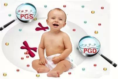第三代试管婴儿 PGT